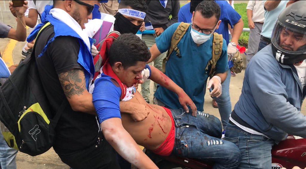 Once personas, entre ellos niños, resultaron heridas por armas de fuego tras el ataque de los paramilitares orteguistas. Foto: tomada de Confidencial