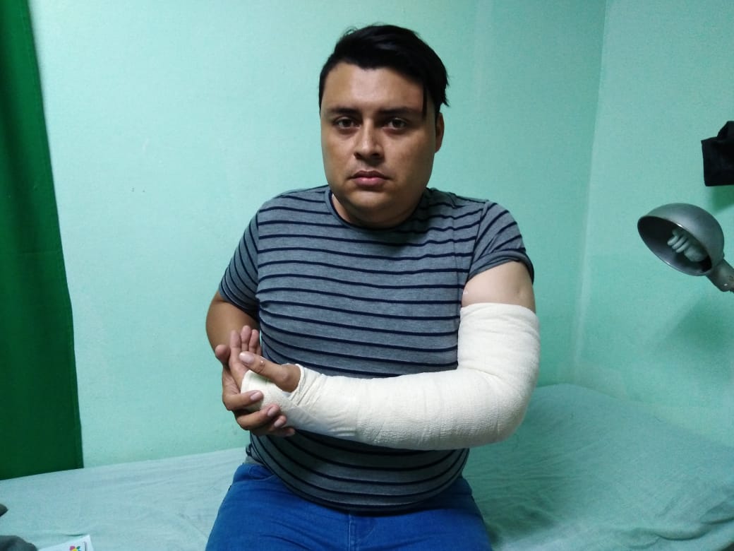 Armando Amaya, periodista de Canal 12, muestra la fractura en su brazo izquierdo producto de la agresión de los agentes policiales del régimen. Foto: Cortesía