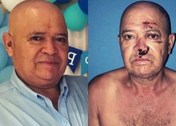 Golpean, secuestran y amenazan a opositor en Matagalpa